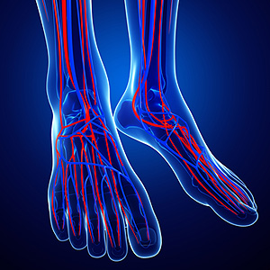 What Is Chronic Venous Insufficiency?