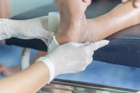 Treatment of Foot Ulcers