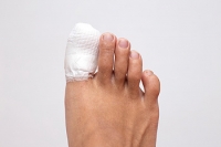 What You Need to Know About Broken Toes