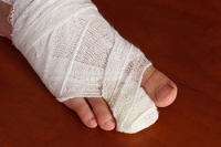 Treatment Options for a Broken Toe