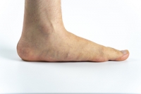 Tips on Running More Comfortably With Flat Feet